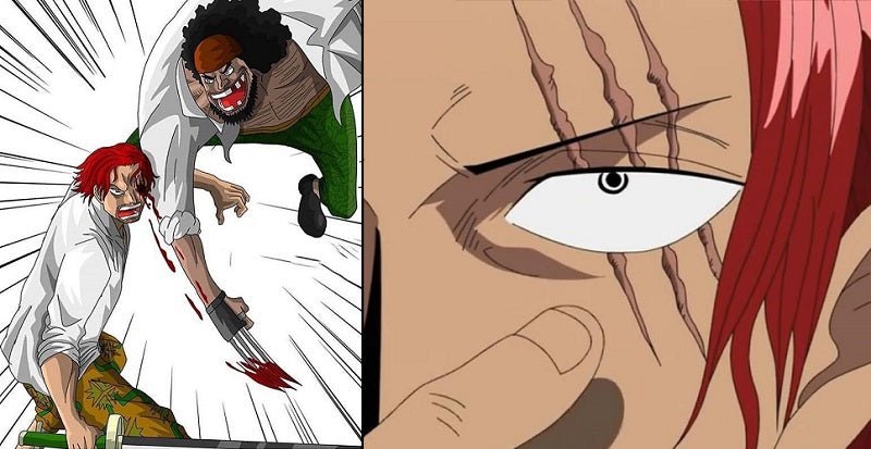 how did blackbeard gave shanks his scar